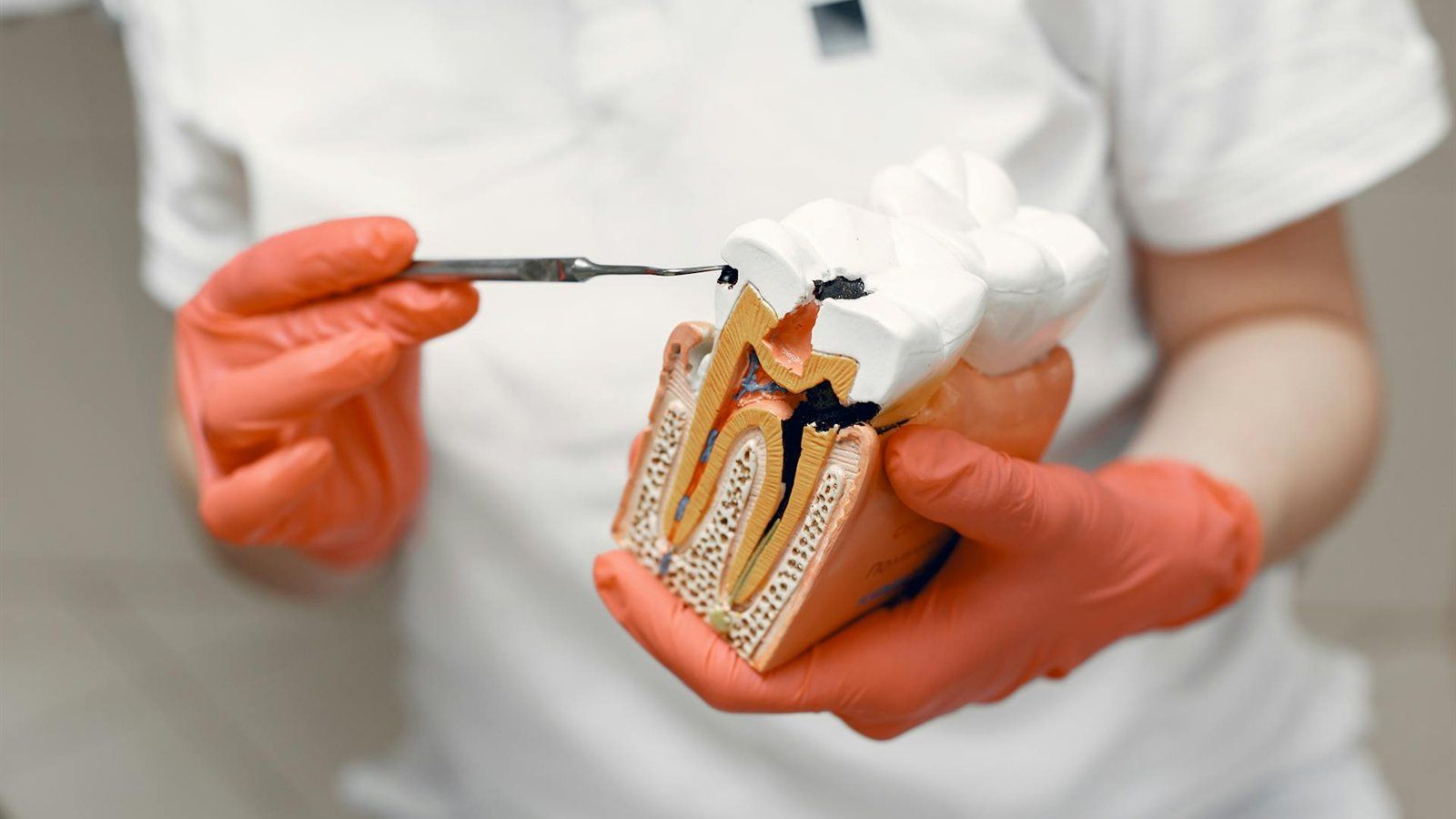 Getting a Root Canal in Gurugram? Here's What Nobody Tells You