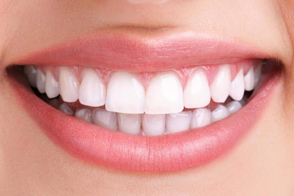 Smile Makeover in Gurugram: Veneers, Aligners & Whitening Options Explained by a Cosmetic Dentist